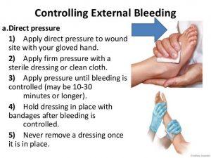 External Bleeding - Hampson Training Academy