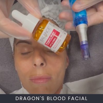 Dragon's Blood Facial