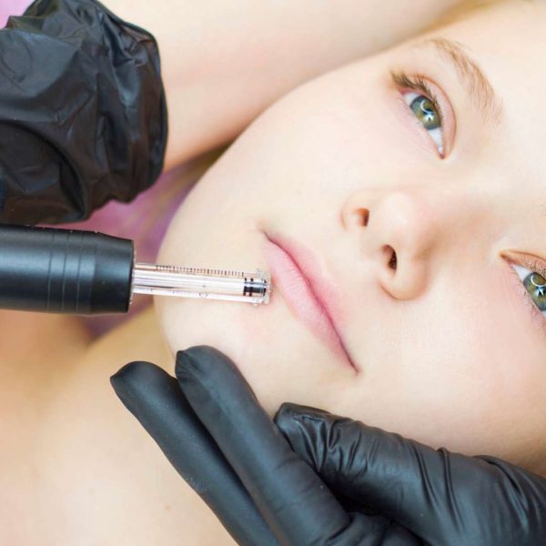 Online Hyaluron Pen - No Needle Filler Course | The Online Beauty Courses