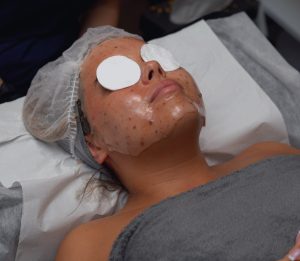 oxybrasion facial